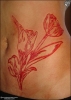 scarification