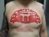 scarification