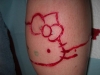 scarification