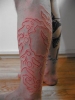 scarification