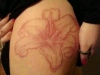 scarification