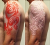 scarification