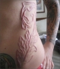 scarification