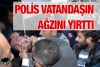 polis tarafından ağzı yırtılan kürt / #712637